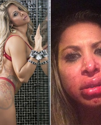 Miss Bumbum Juliana Guerim leva porrada na cara