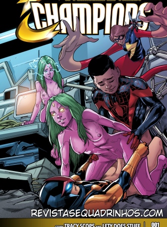 Tracy Scops – Champions by Kall Alves (PT-BR)